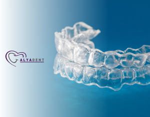 Diş teli Invisalign, metal diş teli ve Kendin yapabileceğiniz diş telleri hakkında bilgiler
