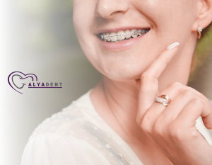 Diş Teli Maliyeti Her Kuruşuna Değer