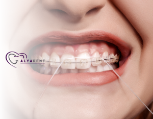 Diş telleri ile diş ipi nasıl kullanılır