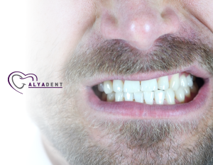 Dişlerinizi Gıcırdatıyor Musunuz Nasıl Durdurulur