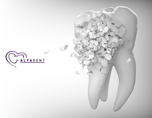 Şeker Çürüklere Neden Olur mu ?